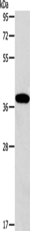 Anti-Human/Mouse/Rat ALDOB Antibody - ABMIUM