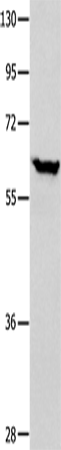 Anti-Human/Mouse DNAJC7 Antibody - ABMIUM