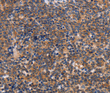 Anti-Human/Mouse ALG9 Antibody - ABMIUM