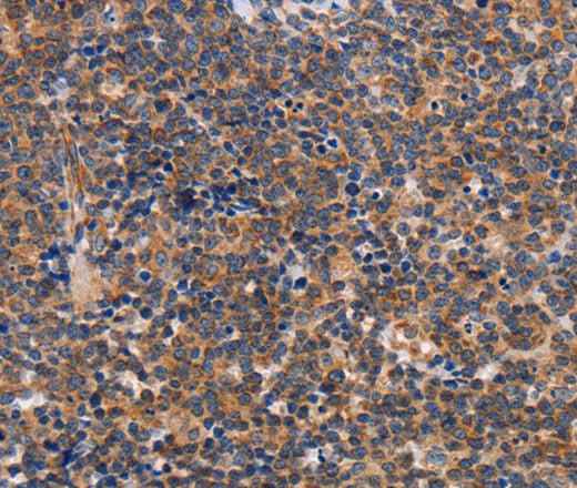 Anti-Human/Mouse ALG9 Antibody