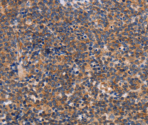 Anti-Human/Mouse ALG9 Antibody - ABMIUM