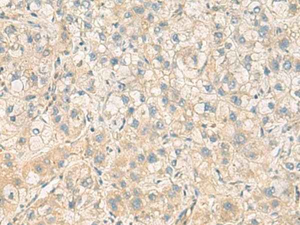 Anti-Human/Mouse PPM1M Antibody