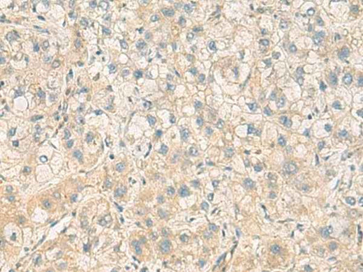 Anti-Human/Mouse PPM1M Antibody