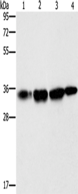 Anti-Human/Mouse NDNL2 Antibody - ABMIUM