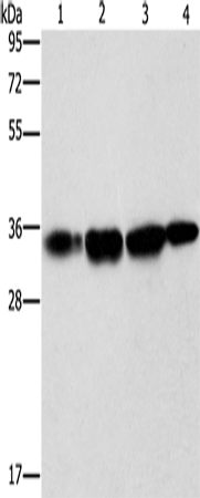 Anti-Human/Mouse NDNL2 Antibody - ABMIUM