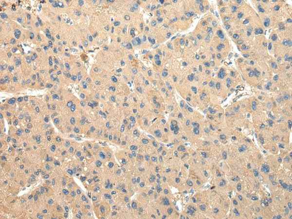 Anti-Human DUSP11 Antibody
