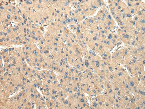 Anti-Human DUSP11 Antibody - ABMIUM