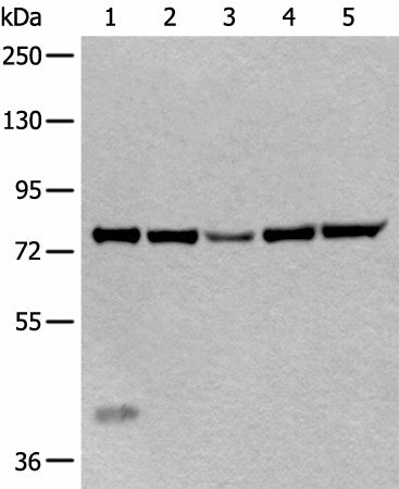 Western blot analysis of Mouse liver tissue Hela cell Human testis tissue Jurkat and HEPG2 cell lysates using ATF6B Polyclonal Antibody at dilution of 1:300
