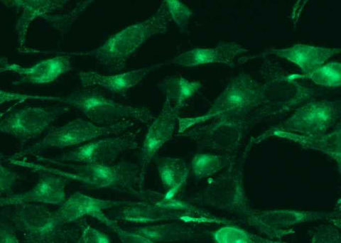 Anti-Human TFRC Antibody [B284] - ABMIUM