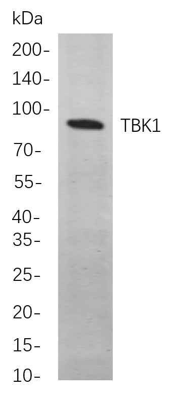 Anti-Human/Mouse/Rat TBK1 Antibody [B792] - ABMIUM