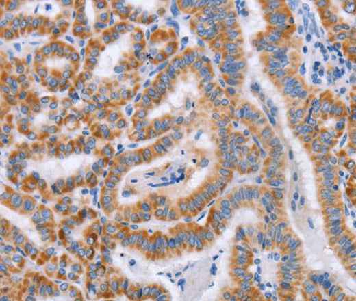 Anti-Human/Mouse/Rat BST1 Antibody