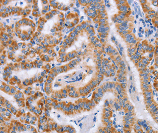 Anti-Human/Mouse/Rat BST1 Antibody - ABMIUM