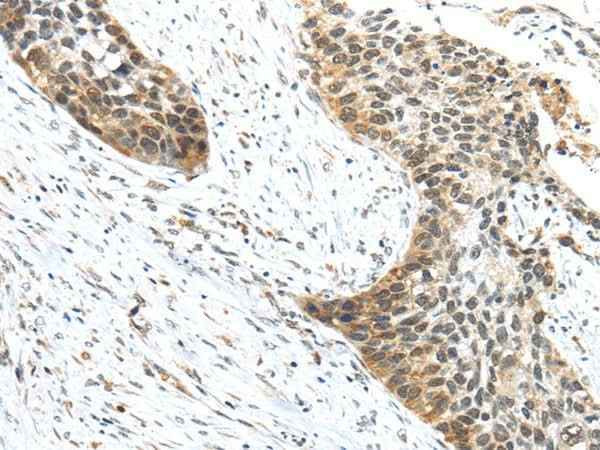 Anti-Human/Mouse TRIP6 Antibody