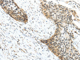 Anti-Human/Mouse TRIP6 Antibody - ABMIUM