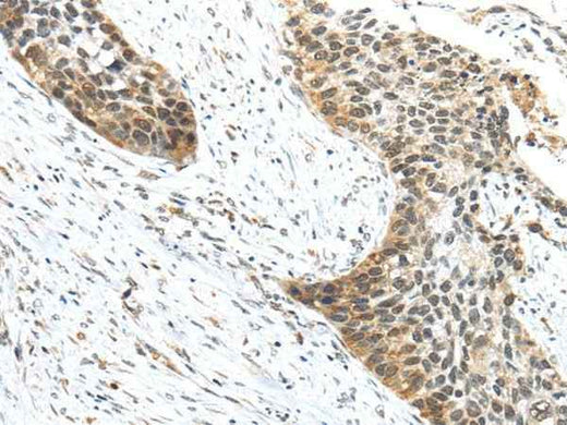 Anti-Human/Mouse TRIP6 Antibody
