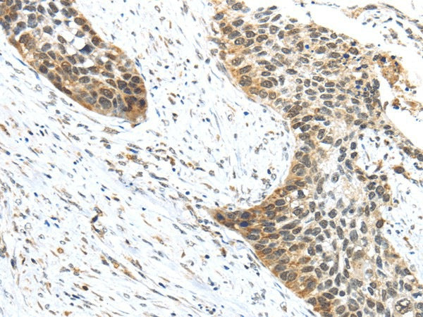 Anti-Human/Mouse TRIP6 Antibody - ABMIUM