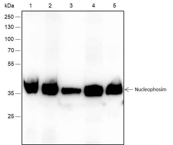 Anti-Human/Rat/Mouse NPM1 Antibody [A315]