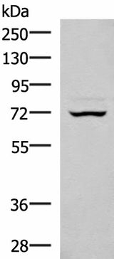 Western blot analysis of 293T cell lysate using EIF2AK1 Polyclonal Antibody at dilution of 1:350