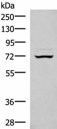 Western blot analysis of 293T cell lysate using EIF2AK1 Polyclonal Antibody at dilution of 1:350