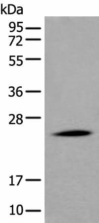 Anti-Human APOD Antibody - ABMIUM