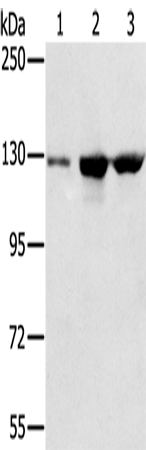 Anti-Human/Mouse NAT10 Antibody - ABMIUM