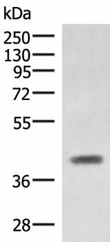 Western blot analysis of Mouse liver tissue lysate using SAMSN1 Polyclonal Antibody at dilution of 1:1000