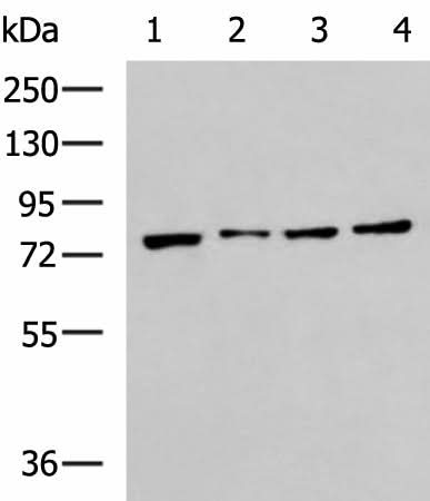 Western blot analysis of RAW264.7 MCF7 Jurkat and A431 cell lysates using HSPA5 Polyclonal Antibody at dilution of 1:400