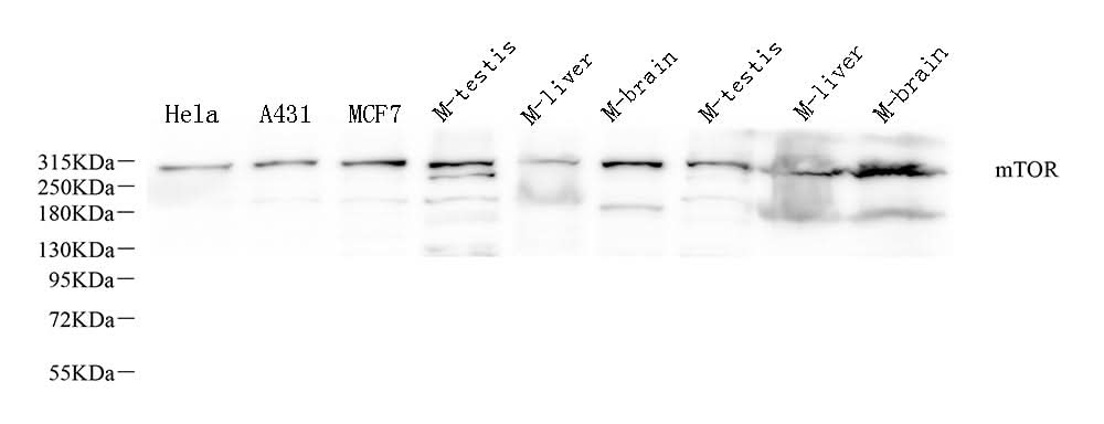 Western Blot analysis of various samples using MTOR Polyclonal Antibody at dilution of 1:1000.