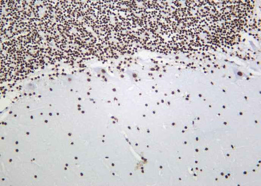 Anti-Human/Mouse/Rat Histone H3 Antibody [B913] - ABMIUM