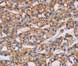 Anti-Human/Mouse ARAP1 Antibody - ABMIUM
