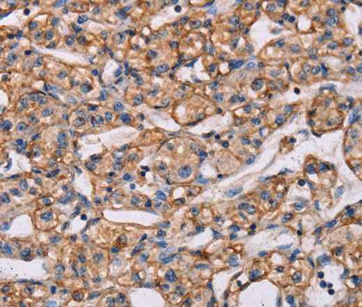 Anti-Human/Mouse ARAP1 Antibody