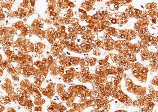 Anti-Human AGT Antibody [B132] - ABMIUM