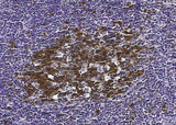 Anti-Human RRM2B Antibody [B359]