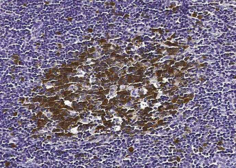 Anti-Human RRM2B Antibody [B359] - ABMIUM