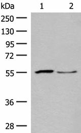 Western blot analysis of Human placenta tissue and PC3 cell lysates using SLC2A8 Polyclonal Antibody at dilution of 1:400