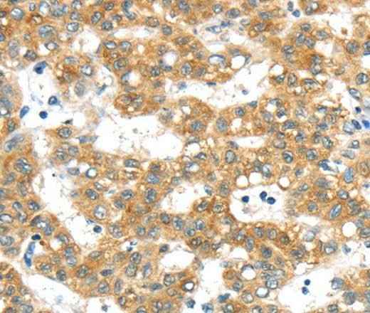 Anti-Human/Mouse PTPN4 Antibody