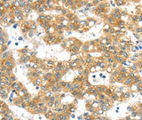 Anti-Human/Mouse PTPN4 Antibody - ABMIUM