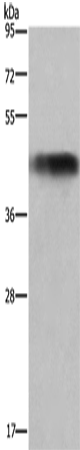 Anti-Human/Mouse/Rat GALT Antibody - ABMIUM