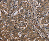 Anti-Human MCC Antibody - ABMIUM