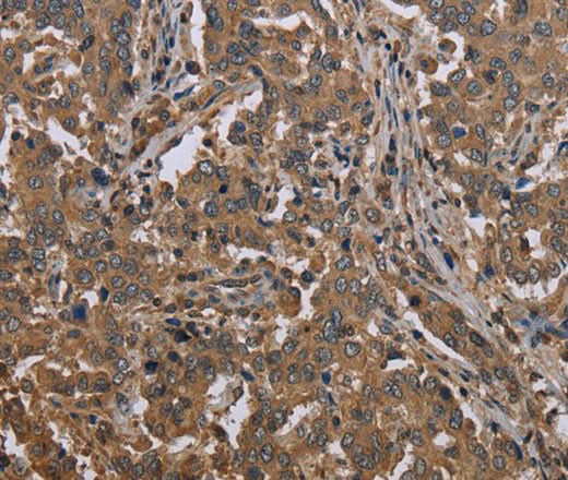 Anti-Human MCC Antibody - ABMIUM