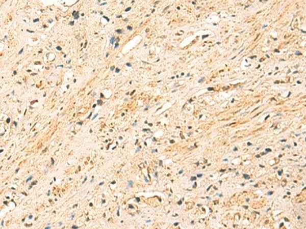 Anti-Human/Mouse EEF1AKMT2 Antibody