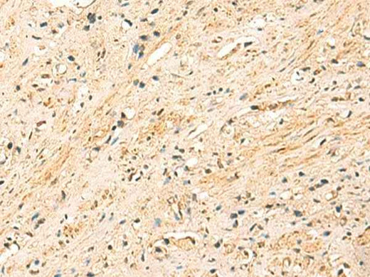 Anti-Human/Mouse EEF1AKMT2 Antibody