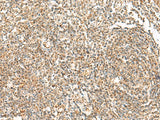 Immunohistochemistry of paraffin-embedded Human tonsil tissue using ORC4 Polyclonal Antibody at dilution of 1:70(×200)
