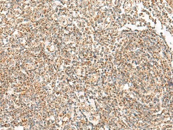 Immunohistochemistry of paraffin-embedded Human tonsil tissue using ORC4 Polyclonal Antibody at dilution of 1:70(×200)