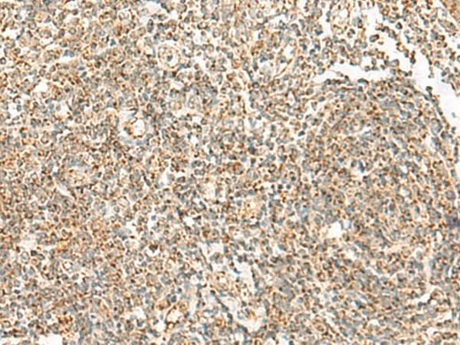 Immunohistochemistry of paraffin-embedded Human tonsil tissue using ORC4 Polyclonal Antibody at dilution of 1:70(×200)
