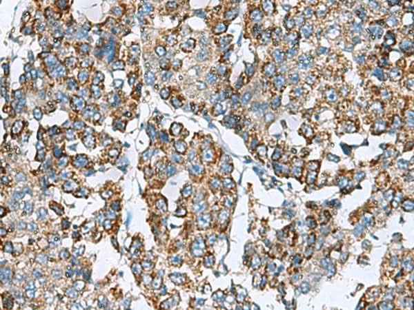 Anti-Human/Mouse/Rat PRELID3B Antibody