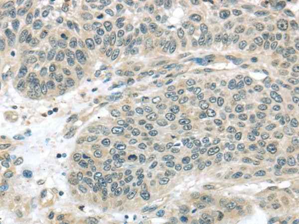Anti-Human/Mouse/Rat THAP4 Antibody