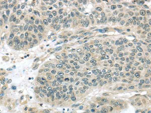 Anti-Human/Mouse/Rat THAP4 Antibody