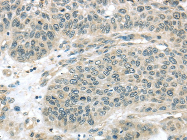 Anti-Human/Mouse/Rat THAP4 Antibody - ABMIUM