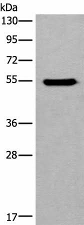 Anti-Human CYP11B2 Antibody - ABMIUM